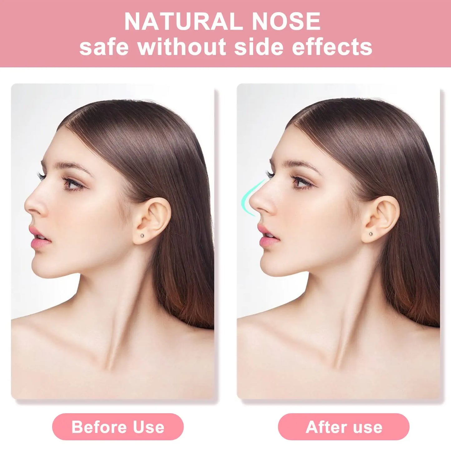 NoseLift Pro Kit – Pain-Free Nose Shaper & Slimmer (3 Sizes)