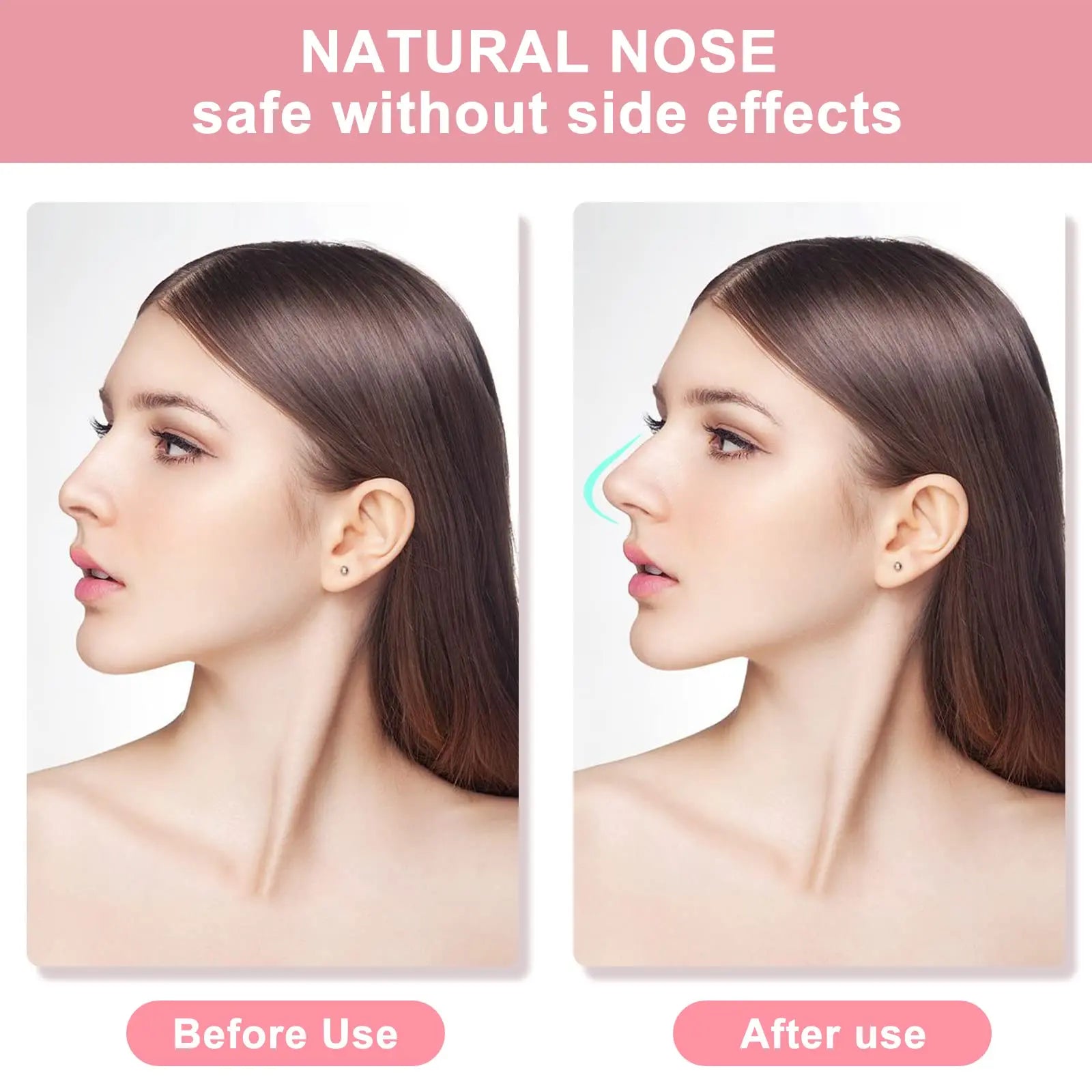 NoseLift Pro Kit – Pain-Free Nose Shaper & Slimmer (3 Sizes)