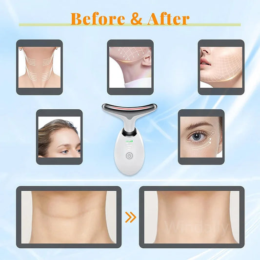 7-Color LED SkinLift Device – Face & Neck Firming Tool by The Youth Spring